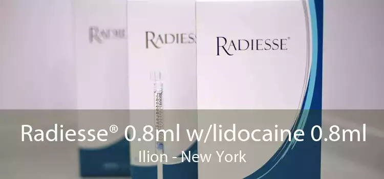 Radiesse® 0.8ml w/lidocaine 0.8ml Ilion - New York