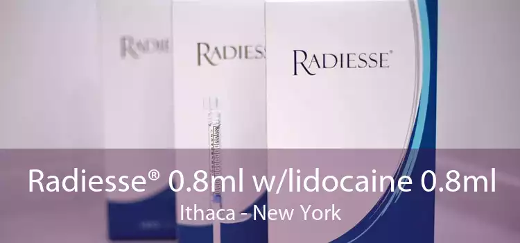 Radiesse® 0.8ml w/lidocaine 0.8ml Ithaca - New York