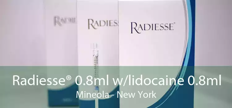 Radiesse® 0.8ml w/lidocaine 0.8ml Mineola - New York