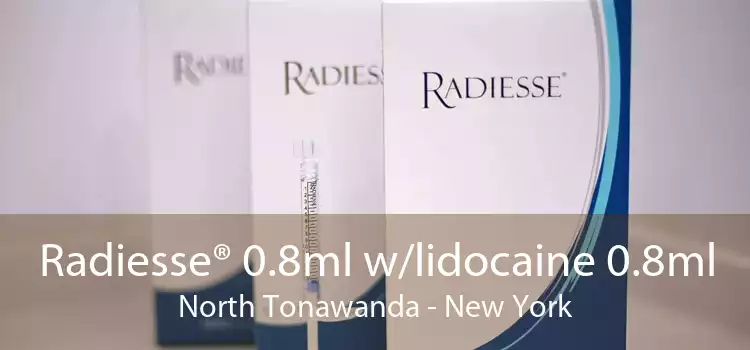 Radiesse® 0.8ml w/lidocaine 0.8ml North Tonawanda - New York