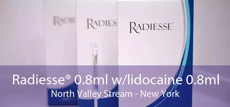 Radiesse® 0.8ml w/lidocaine 0.8ml North Valley Stream - New York