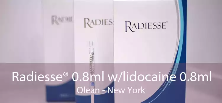 Radiesse® 0.8ml w/lidocaine 0.8ml Olean - New York