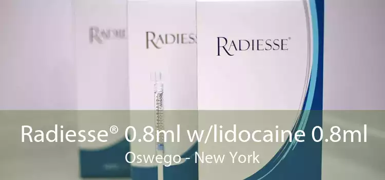 Radiesse® 0.8ml w/lidocaine 0.8ml Oswego - New York