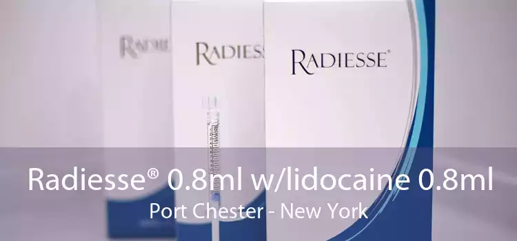 Radiesse® 0.8ml w/lidocaine 0.8ml Port Chester - New York