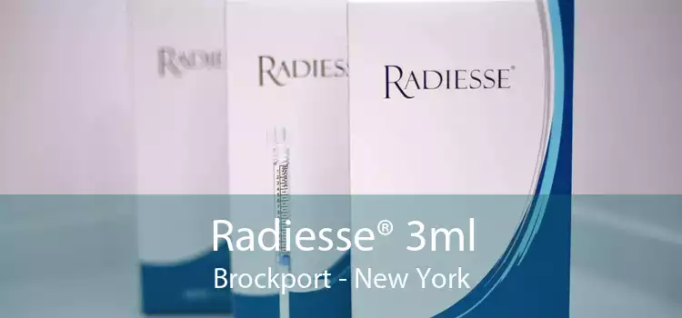 Radiesse® 3ml Brockport - New York