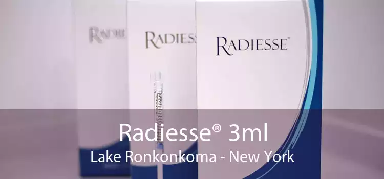 Radiesse® 3ml Lake Ronkonkoma - New York
