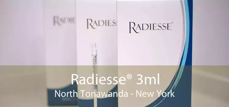 Radiesse® 3ml North Tonawanda - New York