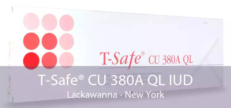 T-Safe® CU 380A QL IUD Lackawanna - New York