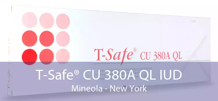 T-Safe® CU 380A QL IUD Mineola - New York
