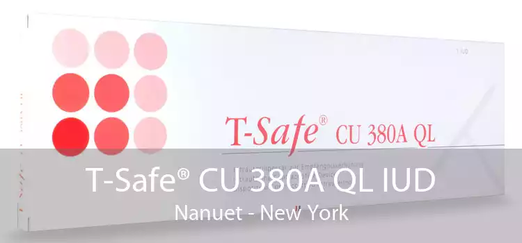 T-Safe® CU 380A QL IUD Nanuet - New York