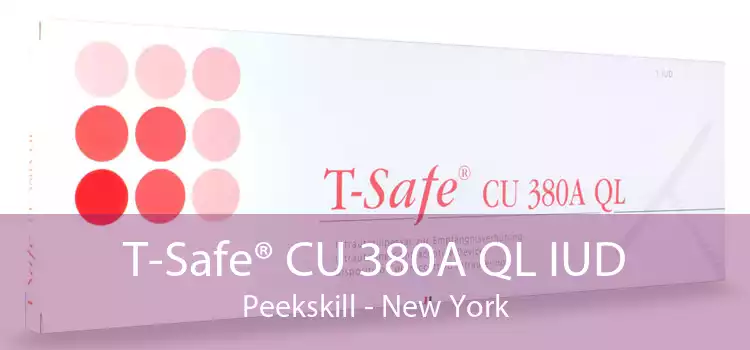 T-Safe® CU 380A QL IUD Peekskill - New York