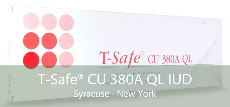 T-Safe® CU 380A QL IUD Syracuse - New York