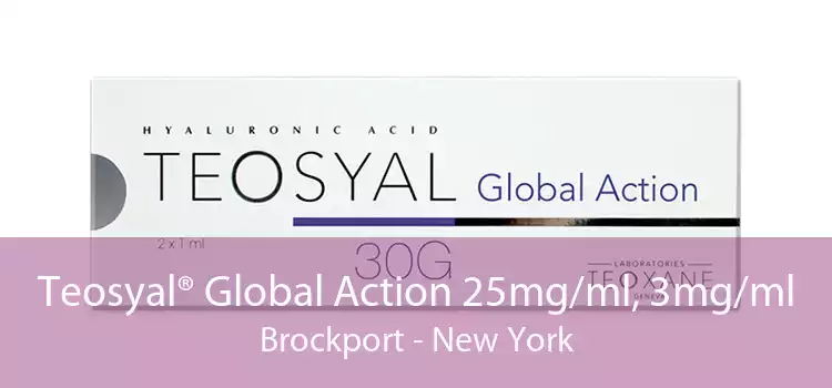 Teosyal® Global Action 25mg/ml, 3mg/ml Brockport - New York