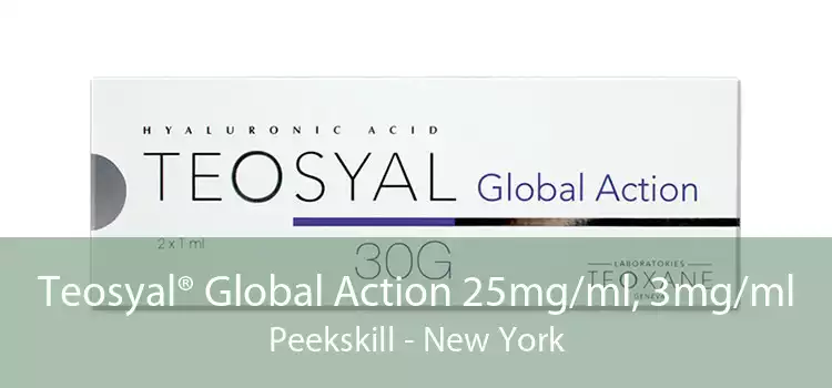 Teosyal® Global Action 25mg/ml, 3mg/ml Peekskill - New York