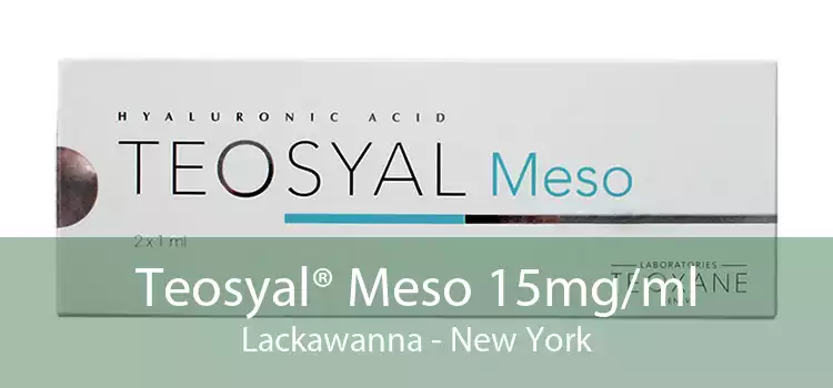 Teosyal® Meso 15mg/ml Lackawanna - New York