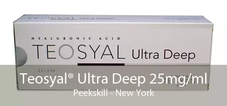 Teosyal® Ultra Deep 25mg/ml Peekskill - New York